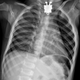 Illustration for article titled The Mystery Of What This Toddler Swallowed Was Quickly Solved
